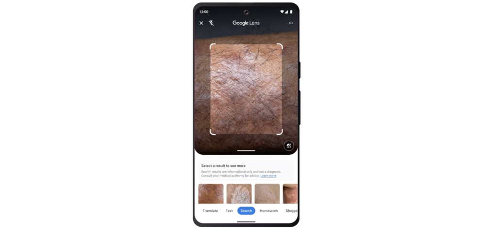 Google Lens recebe nova atualização e passa a reconhecer problemas de pele