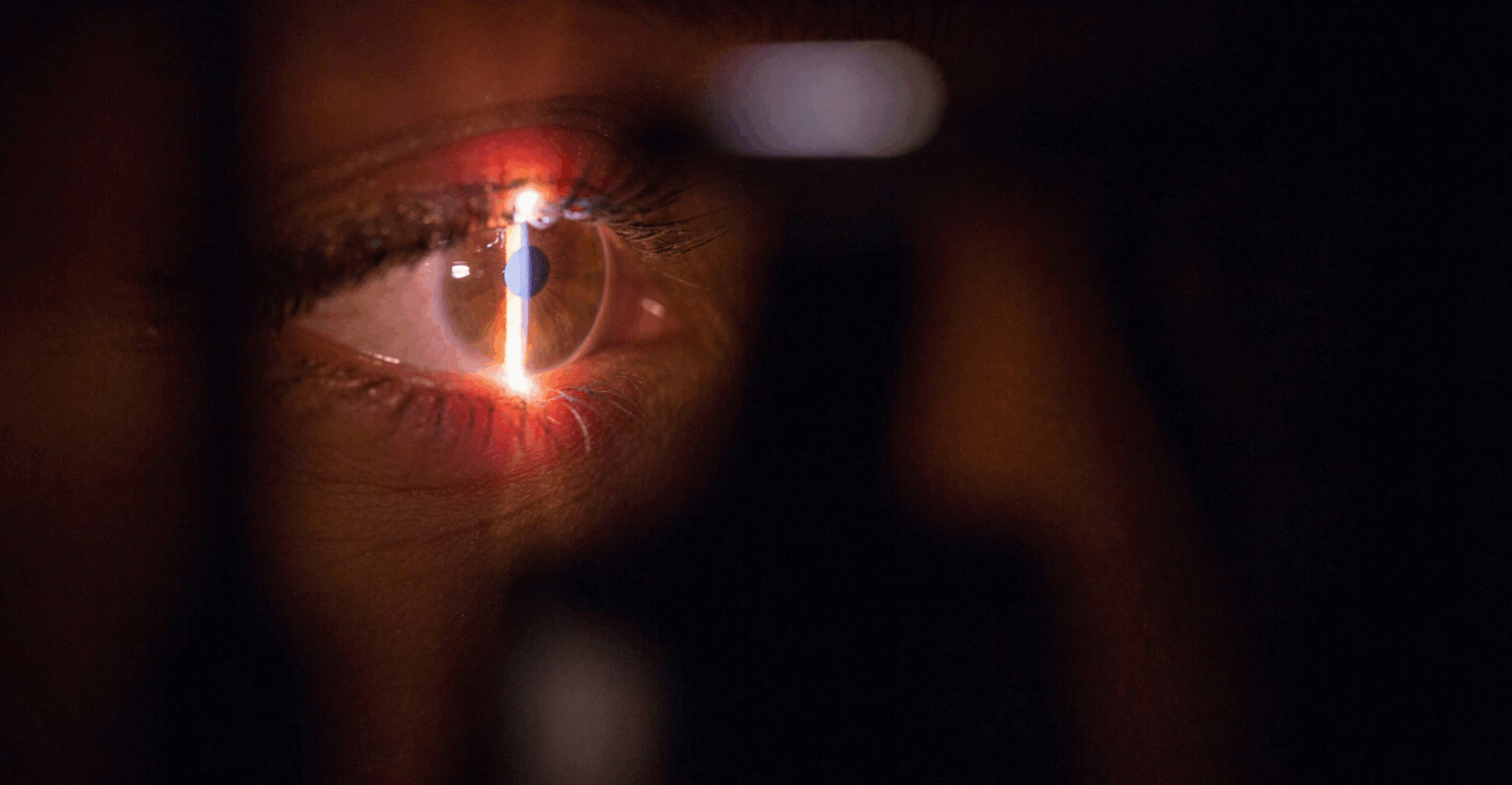 Startup Eyebot capta US$ 20 milhões em rodada Série A eyebot